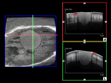 3D波長走査型光干渉断層計による接着修復窩縁部に生じたエナメル質亀裂の評価